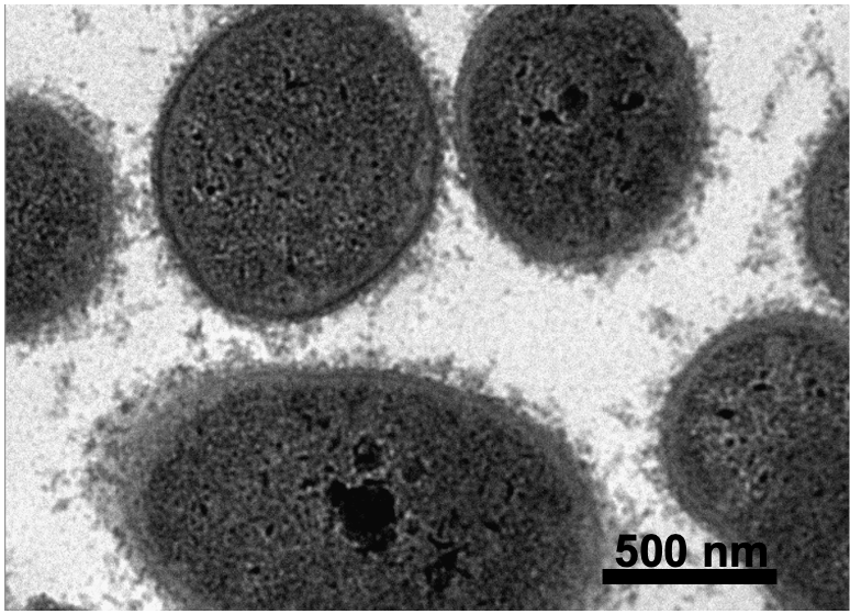 Transmission Electron Microscopy