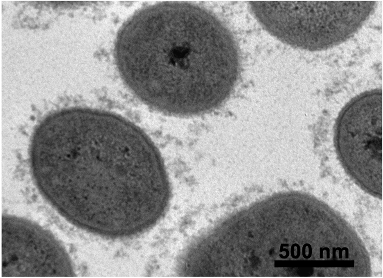 Transmission Electron Microscopy