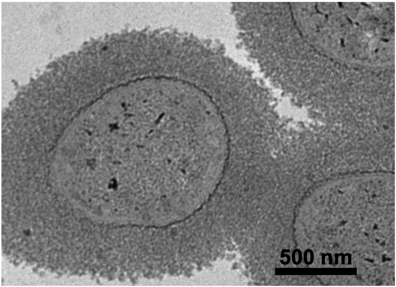 Transmission Electron Microscopy