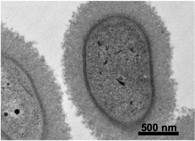 Transmission Electron Microscopy