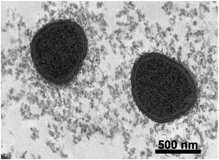 Transmission Electron Microscopy