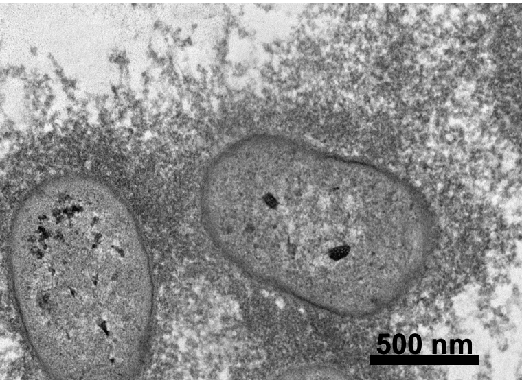 Transmission Electron Microscopy