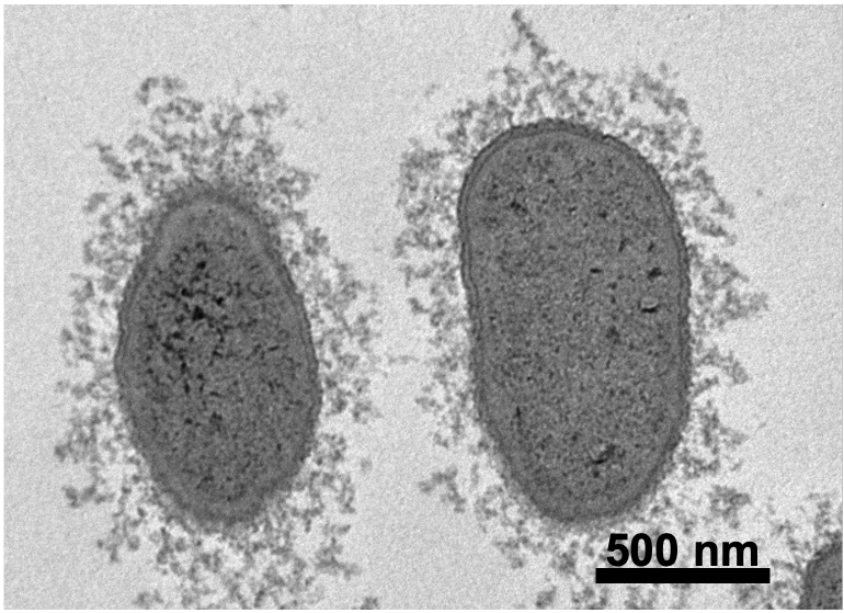 Transmission Electron Microscopy