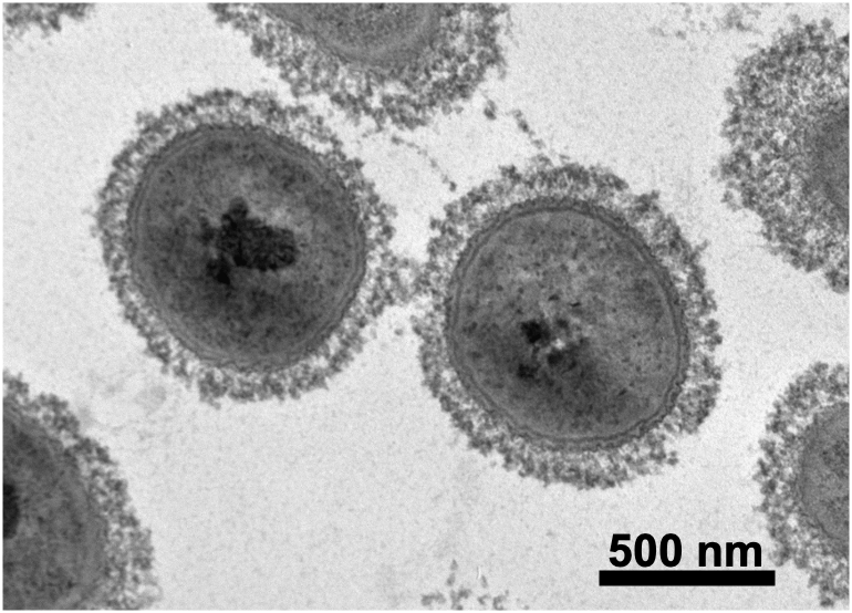 Transmission Electron Microscopy