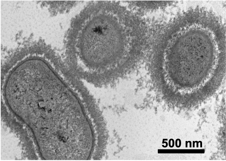 Transmission Electron Microscopy