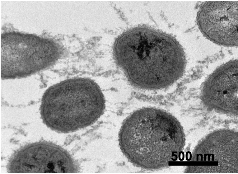 Transmission Electron Microscopy